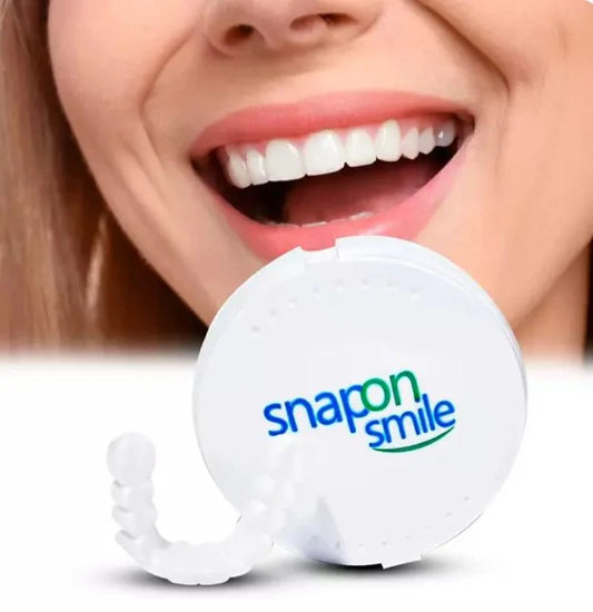 Carillas Dentales Snapon Smile| Lleva la 2 und con un 25% DCTO.